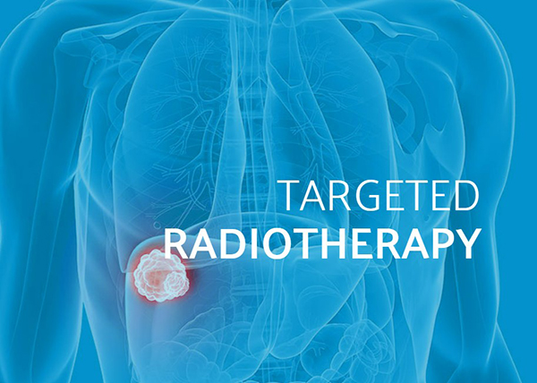 Targeted Radiotherapy