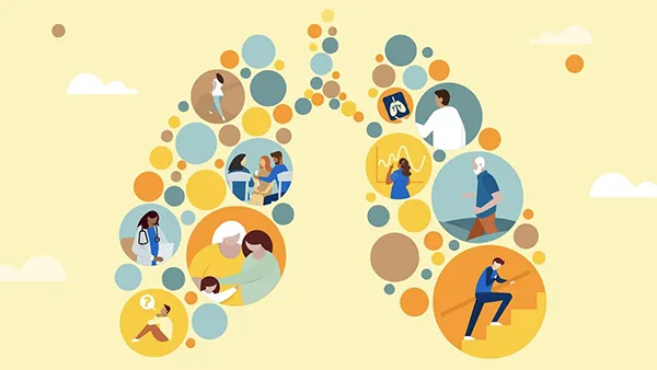 Pulmonary Fibrosis