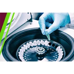 Analytical Development & Validation  Feasibility