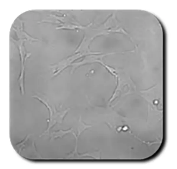HIPPOCAMPAL