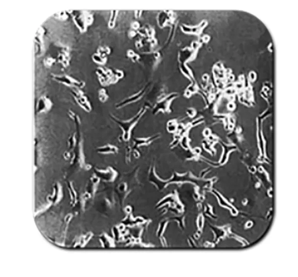 OLIGODENDROCYTIC