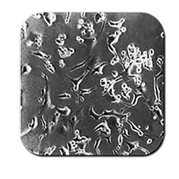 OLIGODENDROCYTIC