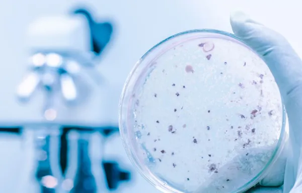 Antimicrobial Preservative Effectiveness Test