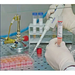Sample Collection,Transport & Processing