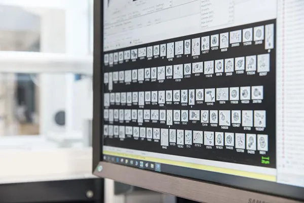 Particle characterization