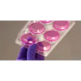 Infectious diseases
