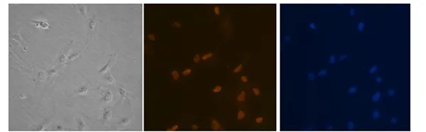 Immortalized Cell Lines
