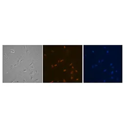 Immortalized Cell Lines