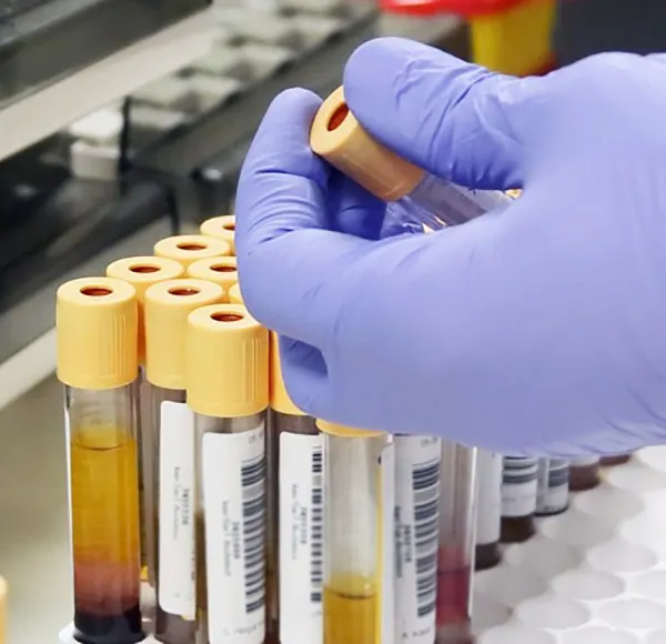 Biobanking and Clinical Kitting