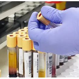 Biobanking and Clinical Kitting