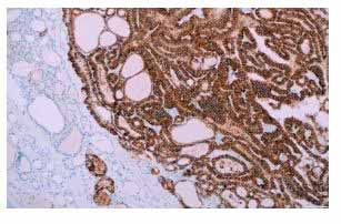 Cell Marque™ IHC Antibodies