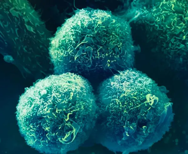 Oncology