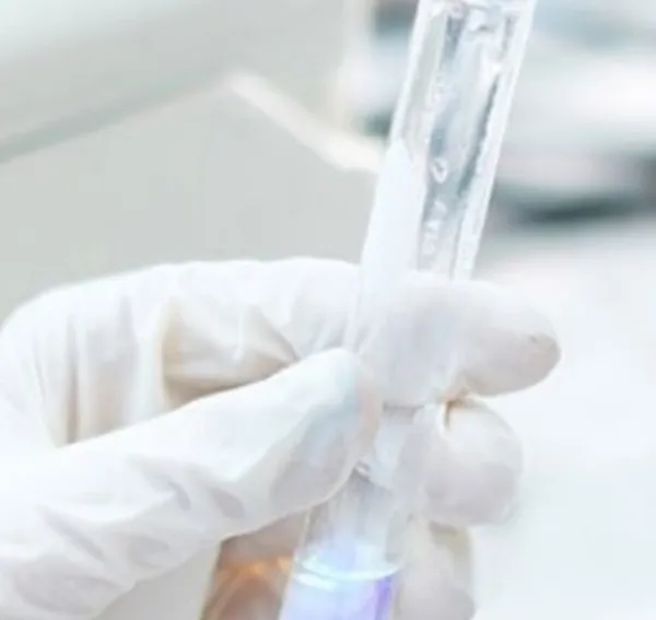 Reversible PEGylation