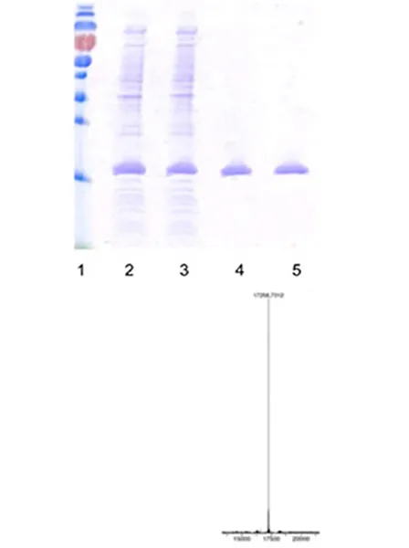 PB (RA)-2010 (Rheumatoid Arthritis)