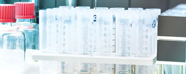 Custom Peptide Synthesis