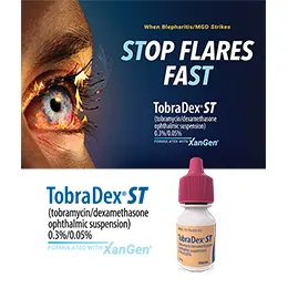 TOBRADEX® ST