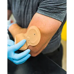 IontoPatch